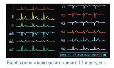 ОБЕРЕГ-1206 - шестиканальный цифровой электрокардиограф арт. 10664